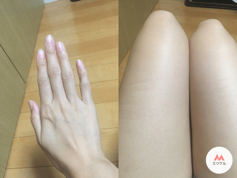 医療脱毛ぶっちゃけどこがいい